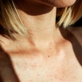 Hives vs. Rashes — How to Spot the Differences, According to Experts