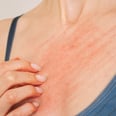 Itchy Nipples? A Lactation Expert Shares 9 Potential Causes