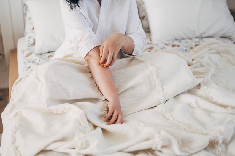 Sensitive skin allergic concept, Woman itching on her arm have a red rash from allergy symptom and from scratching.