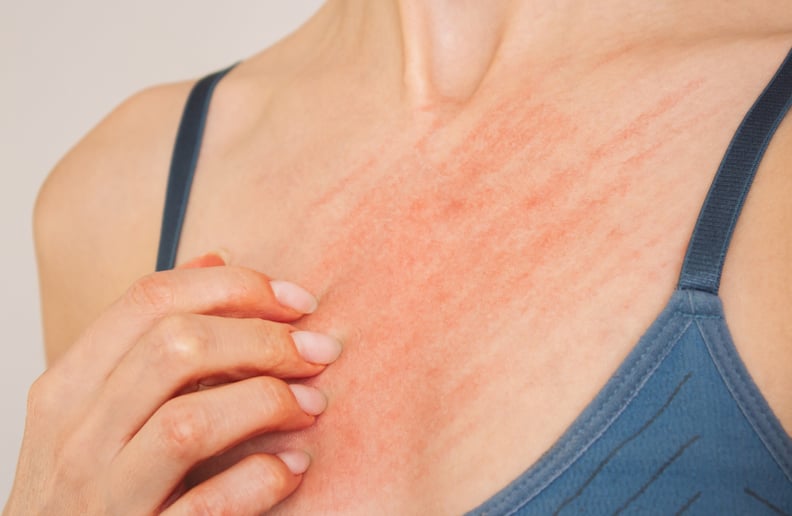 Woman in blue underwear who scratches her breasts and suffers from allergies.